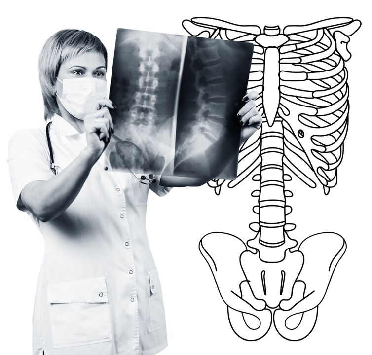 Radiographie der Lendenwirbelsäule