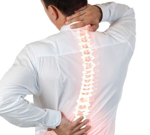Osteochondrose der Wirbelsäule bei einem Mann