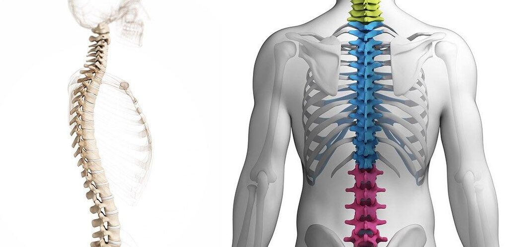 Läsion der Brustwirbelsäule mit Osteochondrose